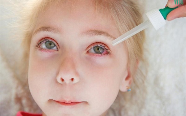 Cách phòng bệnh đau mắt đỏ cho trẻ em