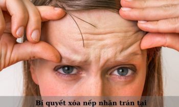 bí quyết xóa nếp nhăn trán tại nhà