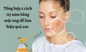 Các cách trị nám bằng mật ong đơn giản hiệu quả cao