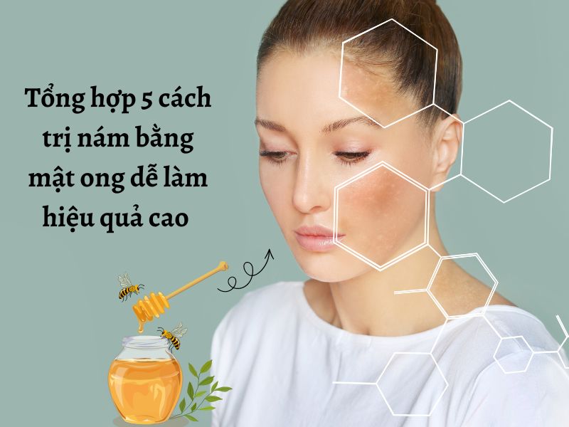 Các cách trị nám bằng mật ong đơn giản hiệu quả cao 