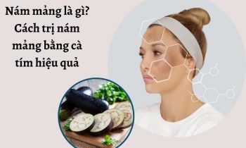 Cách trị nám mảng bằng cà tím hiệu quả tại nhà