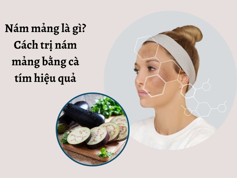 Cách trị nám mảng bằng cà tím hiệu quả tại nhà 