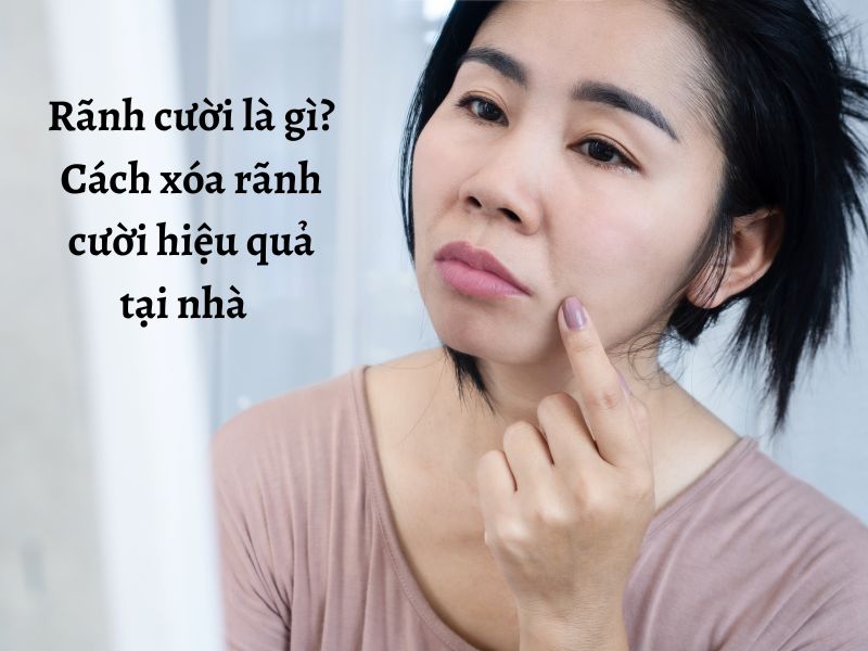 Hướng dẫn cách xóa rãnh cười an toàn hiệu quả tại nhà 