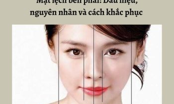 Cách nhận biết mặt lệch bên phải và cách khắc phục tại nhà