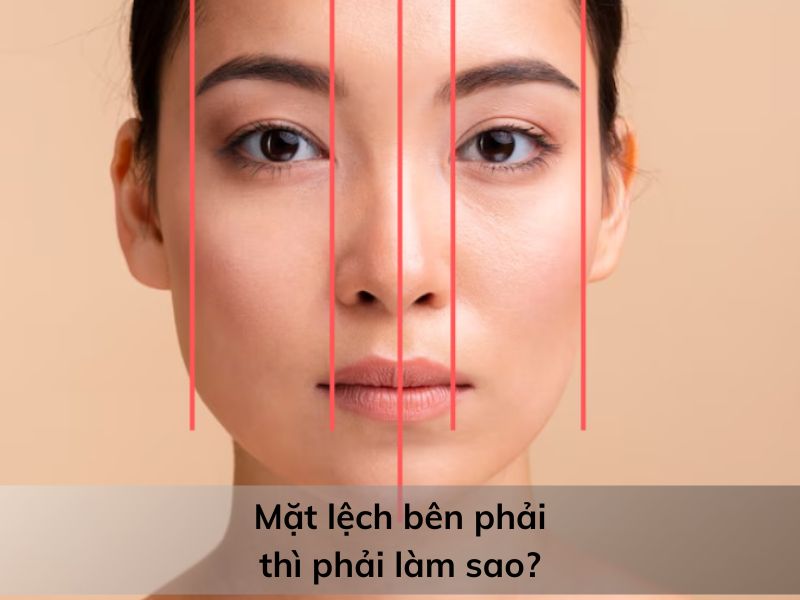 mặt lệch bên phải thì phải làm sao