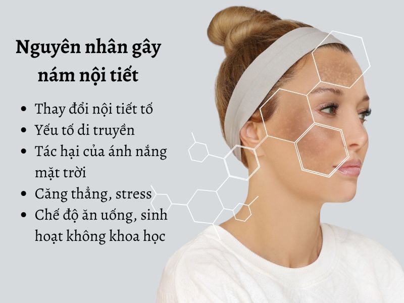 Các nguyên nhân dẫn đến hình thành nám nội tiết trên da 